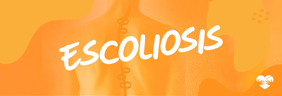Escoliosis: El cuidado de la curvatura de la columna